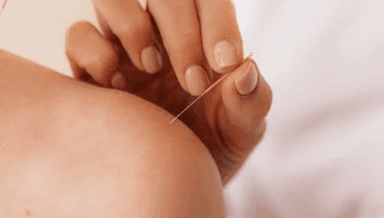 Image for TCM & Acupuncture session